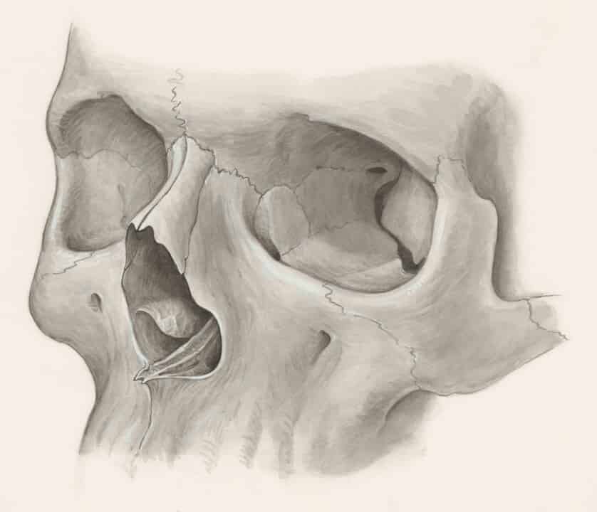 A Narrative Review of the Bifrontal Decompressive Craniotomy in ...