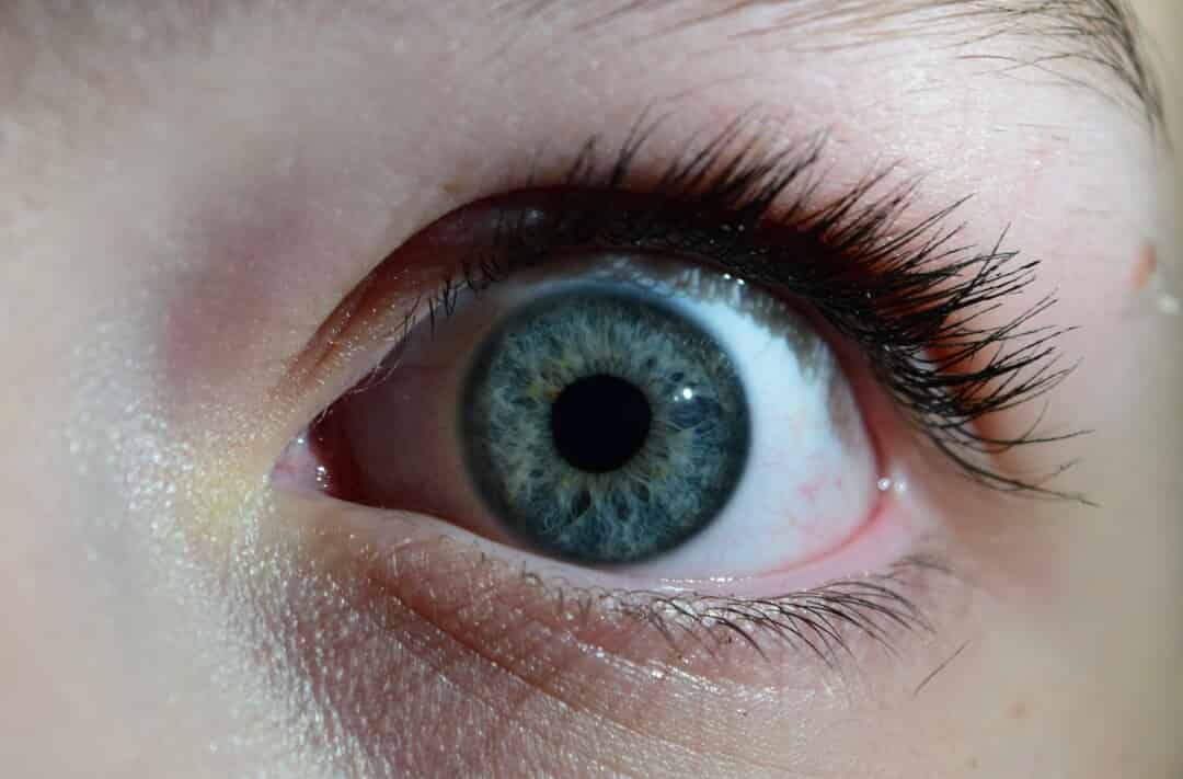 Point-Counterpoint: Cyclopentolate Versus Tropicamide for Cycloplegic ...