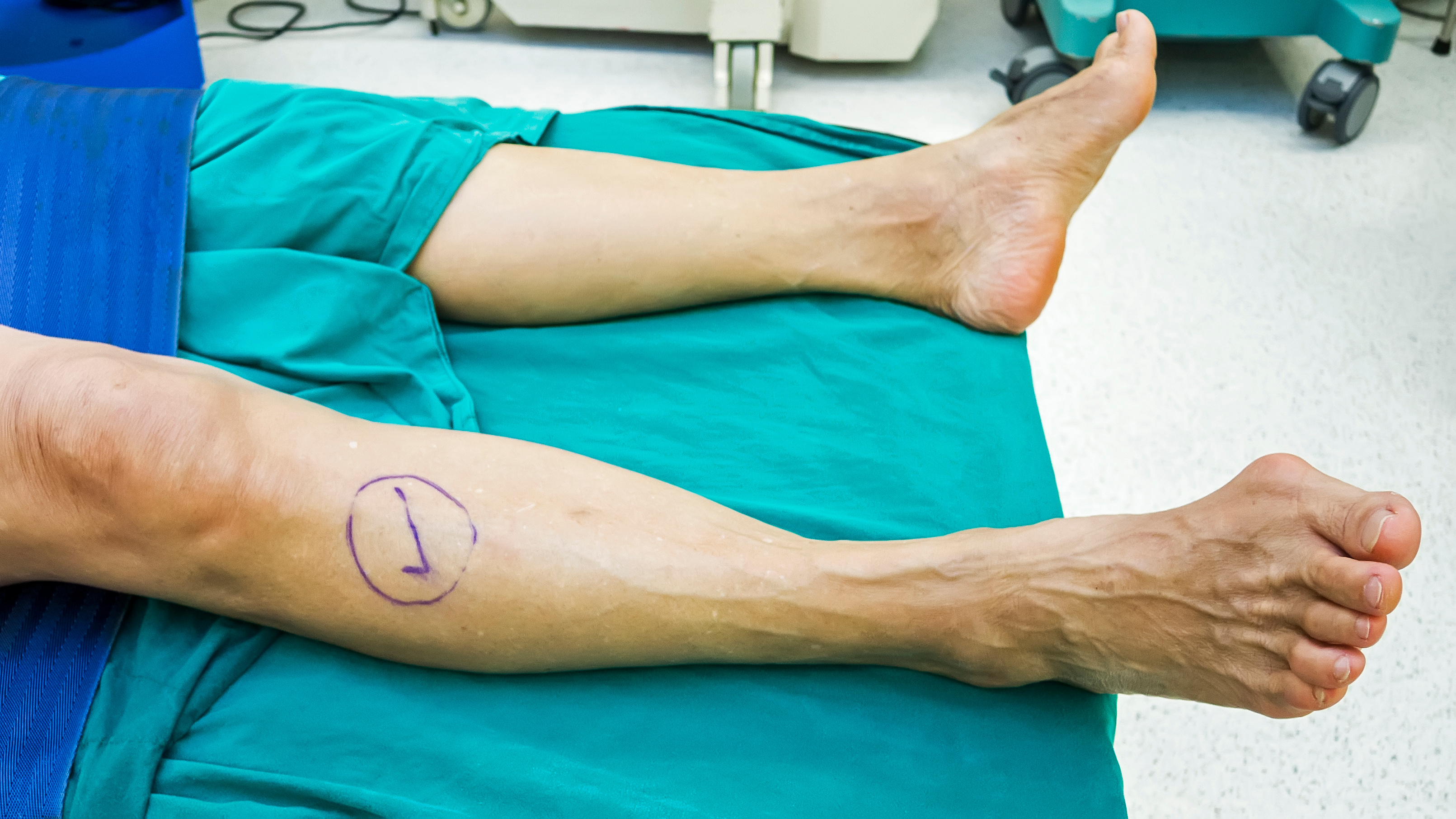 Wrong-Site Surgery: A Study of 664 Events From 237 Facilities