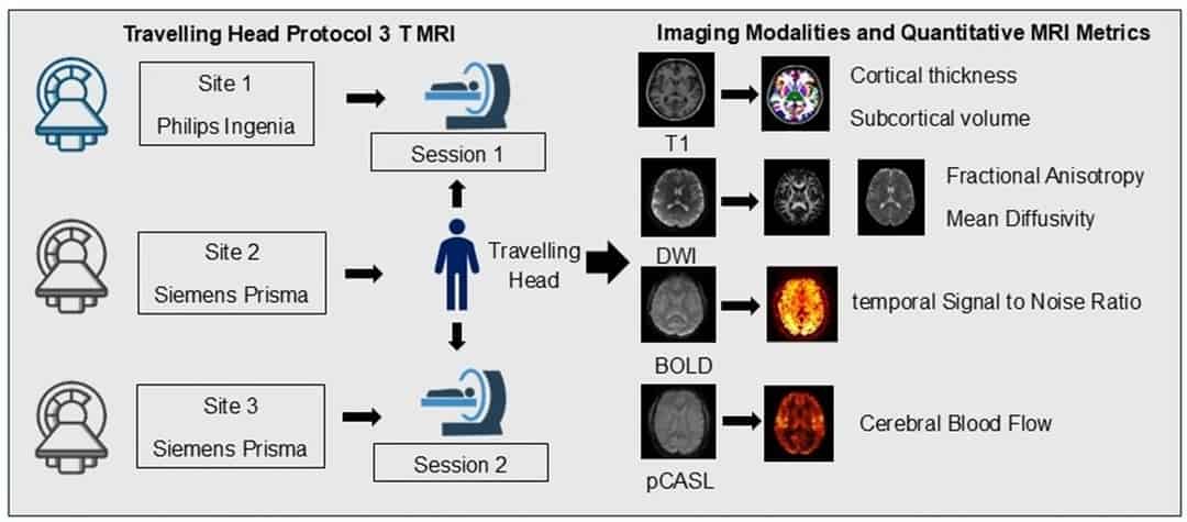 Trafitional Mri Assessing optimisation of 3T MRI protocol across multi-site, multi ...