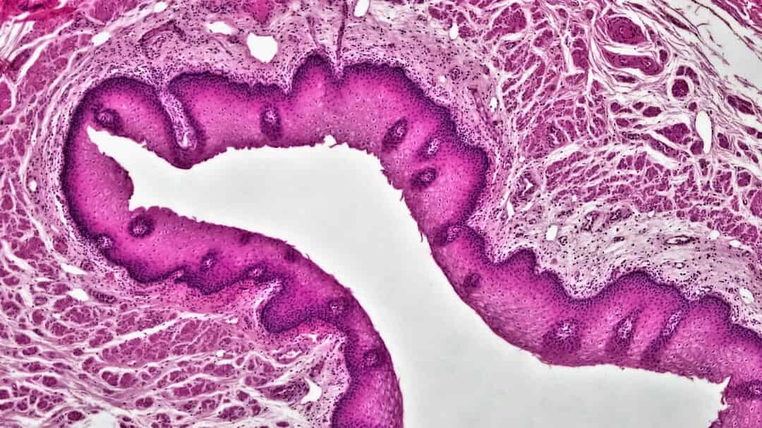 Review of the Pediatric Appendicitis Score | Published in Evidence to ...