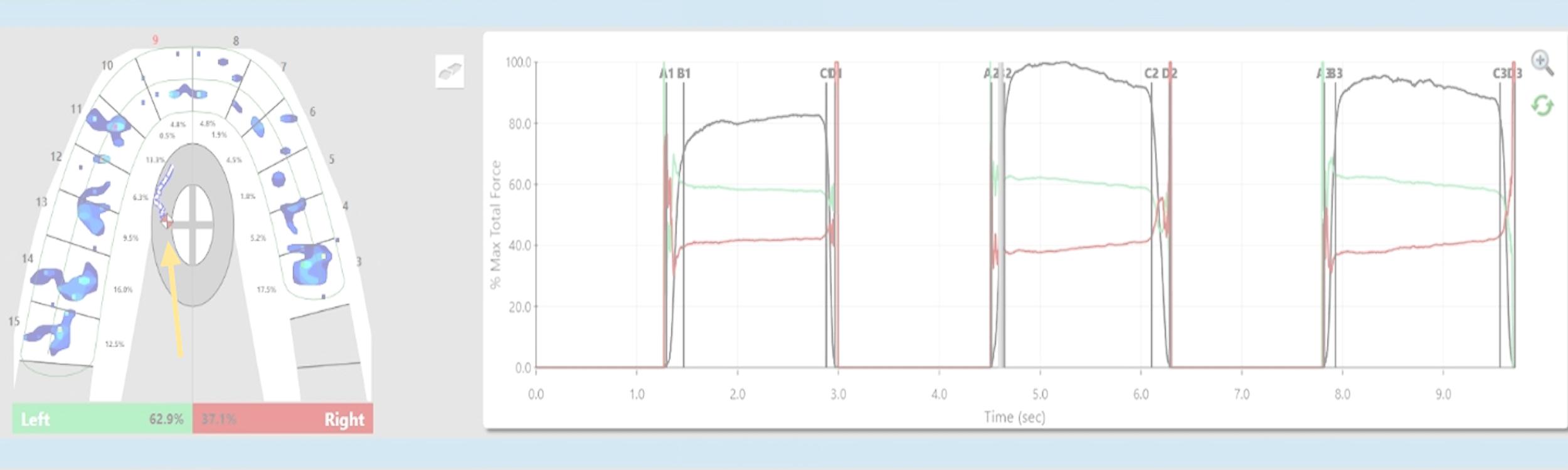 image_for_measuring_change_in_
