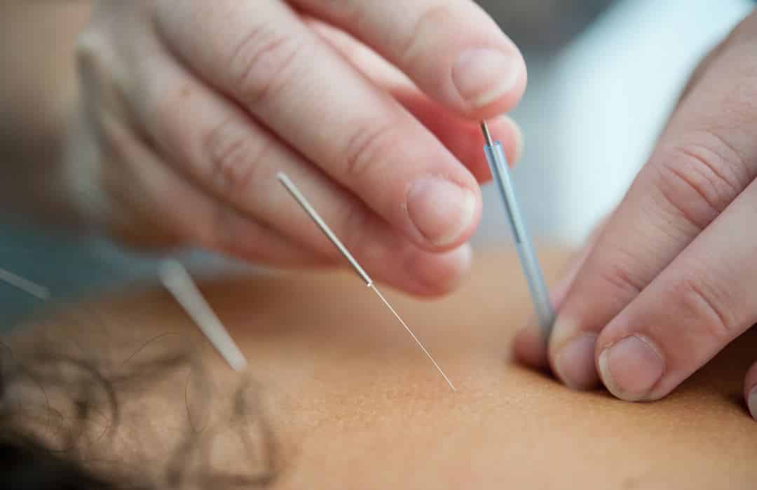iv glutathione alpha lipoic acid for fibromyalgia evidence Efficacy of acupuncture in the treatment of bpc 157 peptide risks dandelion supplement water retention Select Quantity:1 Bottle