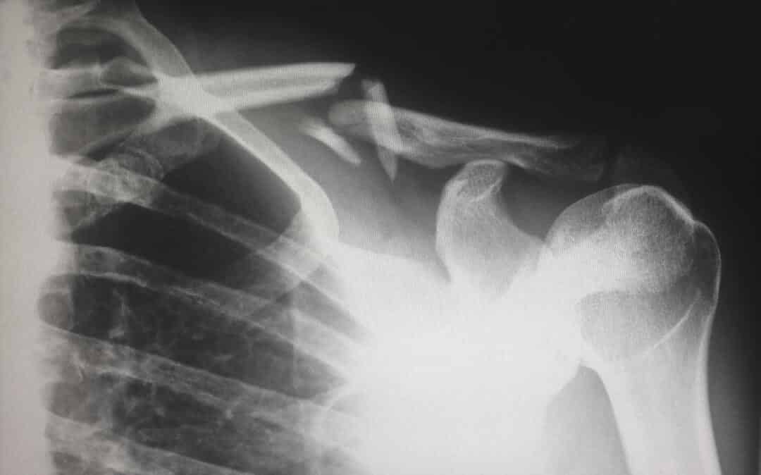 Diagnostic Imaging for Distal Extremity Injuries in Direct Access ...