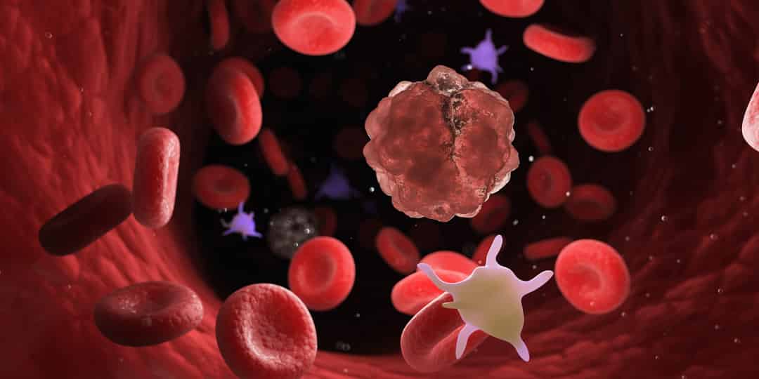 Hematologic Updates from ASH 2022 Published in healthbook TIMES