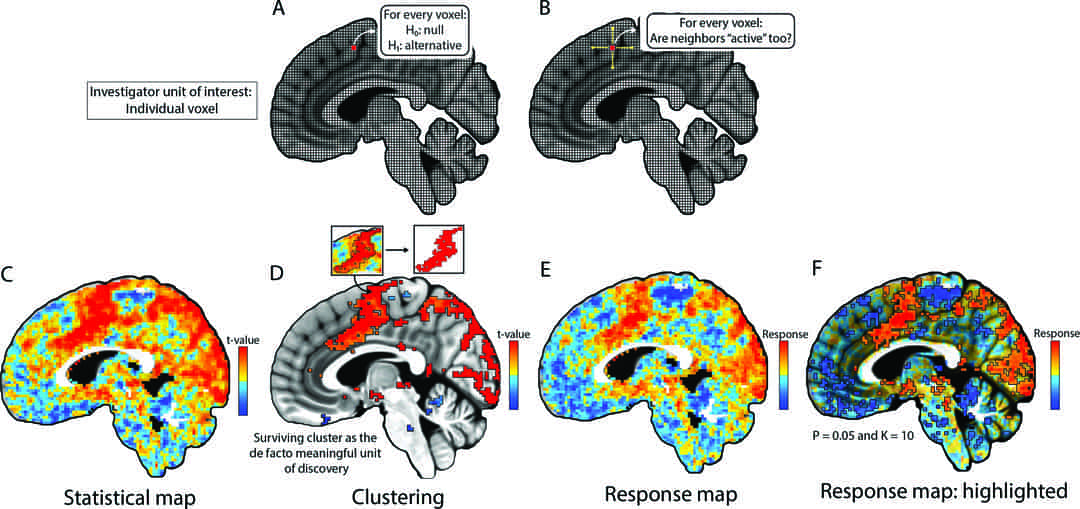 Sources of Information Waste in Neuroimaging: Mishandling Structures ...