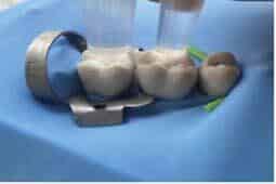 Shell Light Cure Light curing | Published in Journal of the Irish Dental Association
