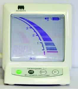 Efficient and effective use of the electronic apex locator