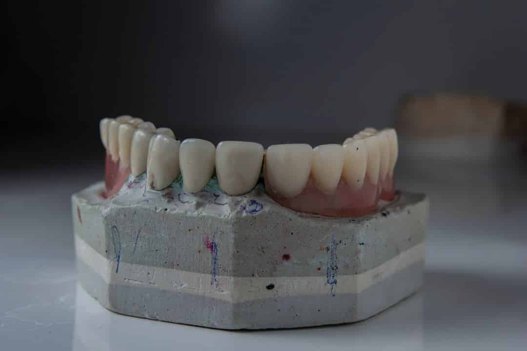 RECREATING MORPHOLOGY FOR IMPROVED CLASS IV RESTORATIONS | Published in ...