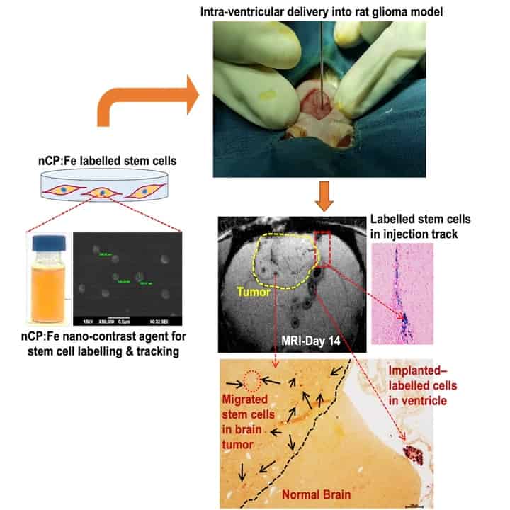 Magnetic resonance imaging of mesenchymal stem cell – migration towards ...