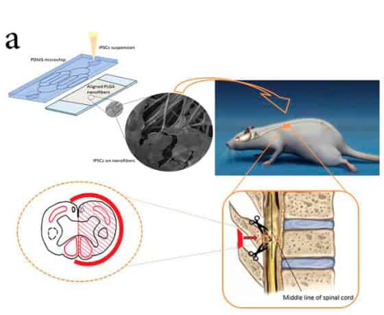 Application of microfluidic systems for neural differentiation of cells ...