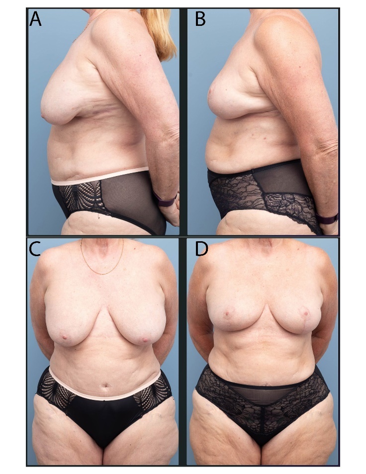 Fig 3