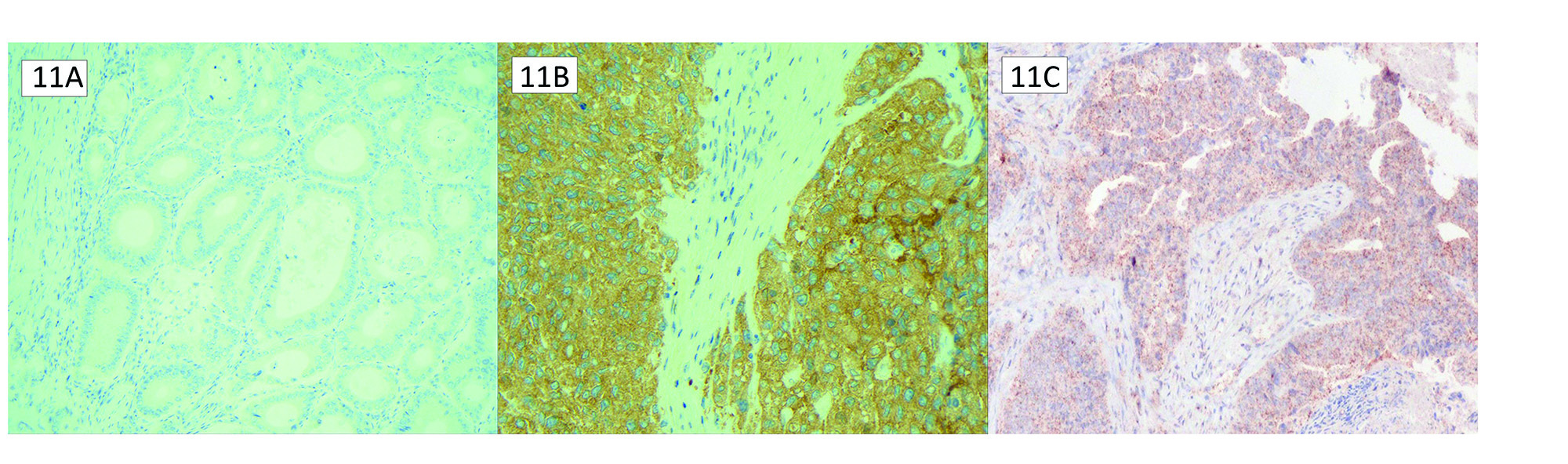 Figure 11