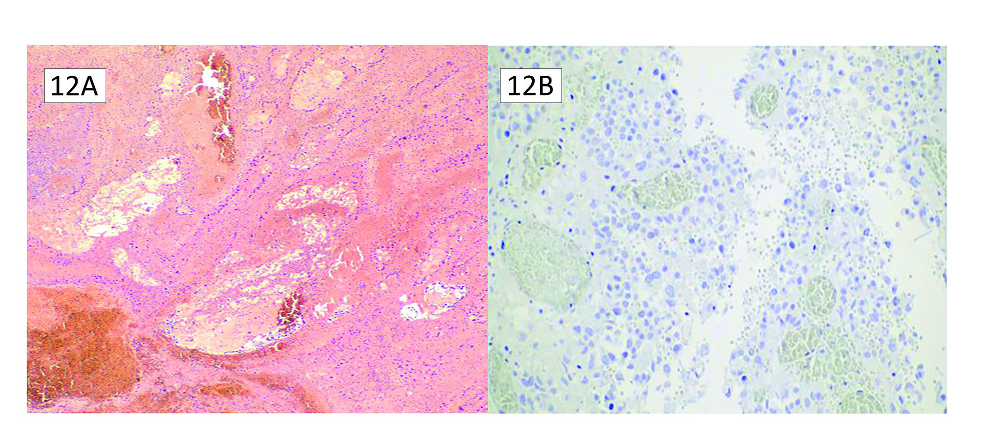 Figure 12
