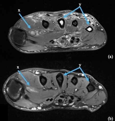Fig 5