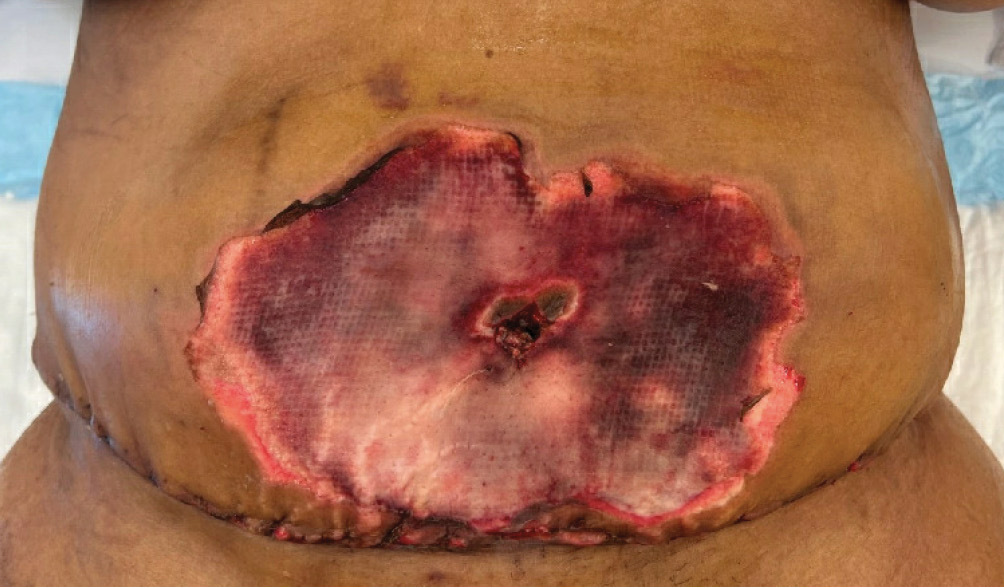 Fig 1