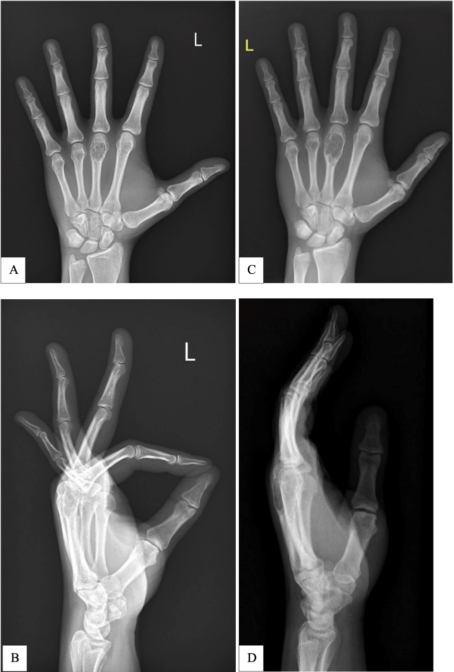 Fig 1