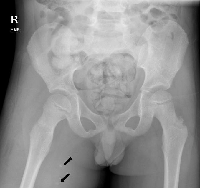 Fig 1