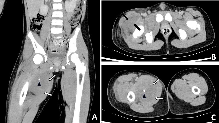 Fig 2