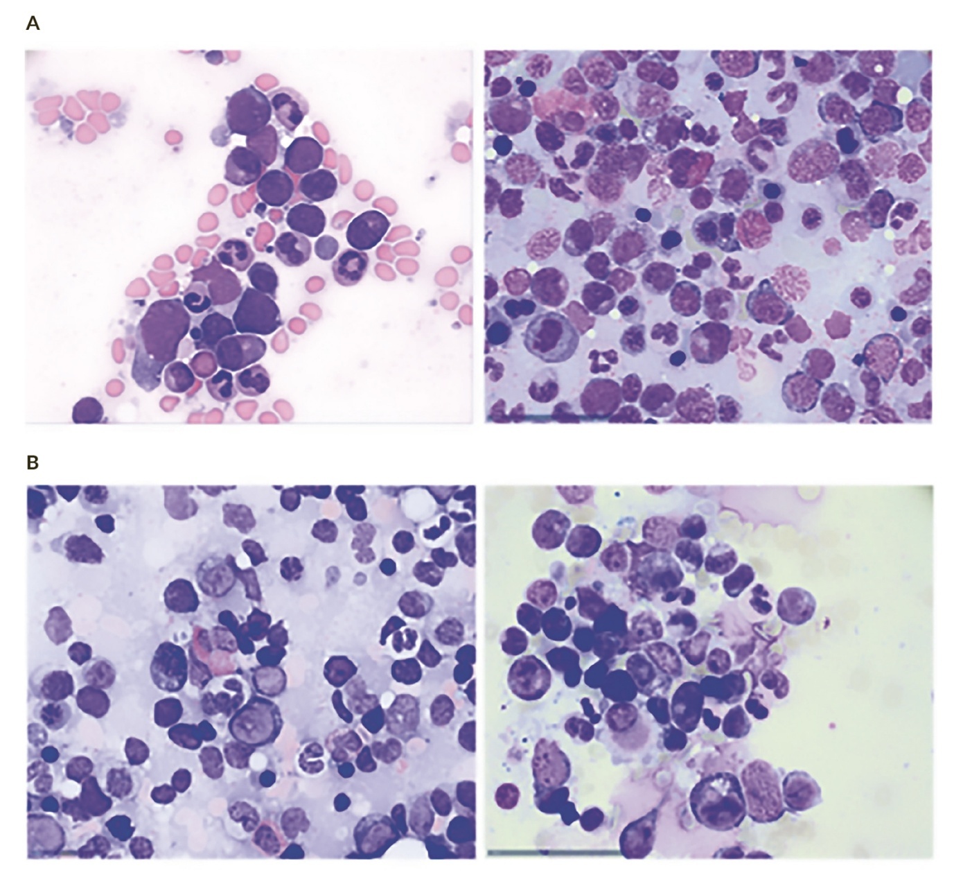A collage of different types of blood cells AI-generated content may be incorrect.