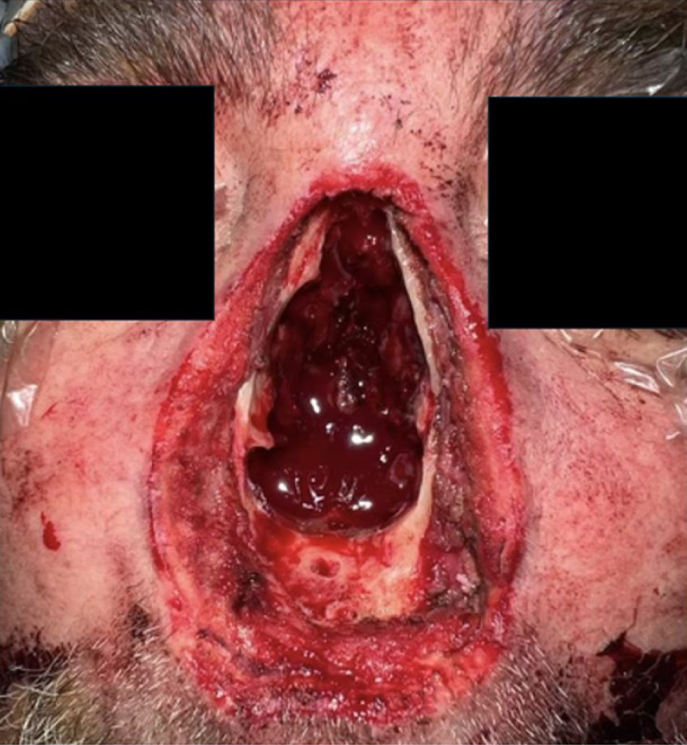 Fig 1