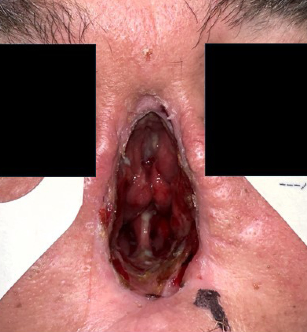 Fig 3