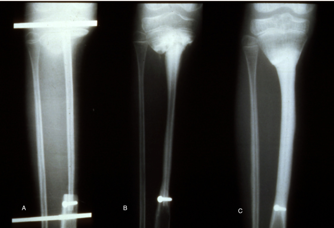 Fig 11