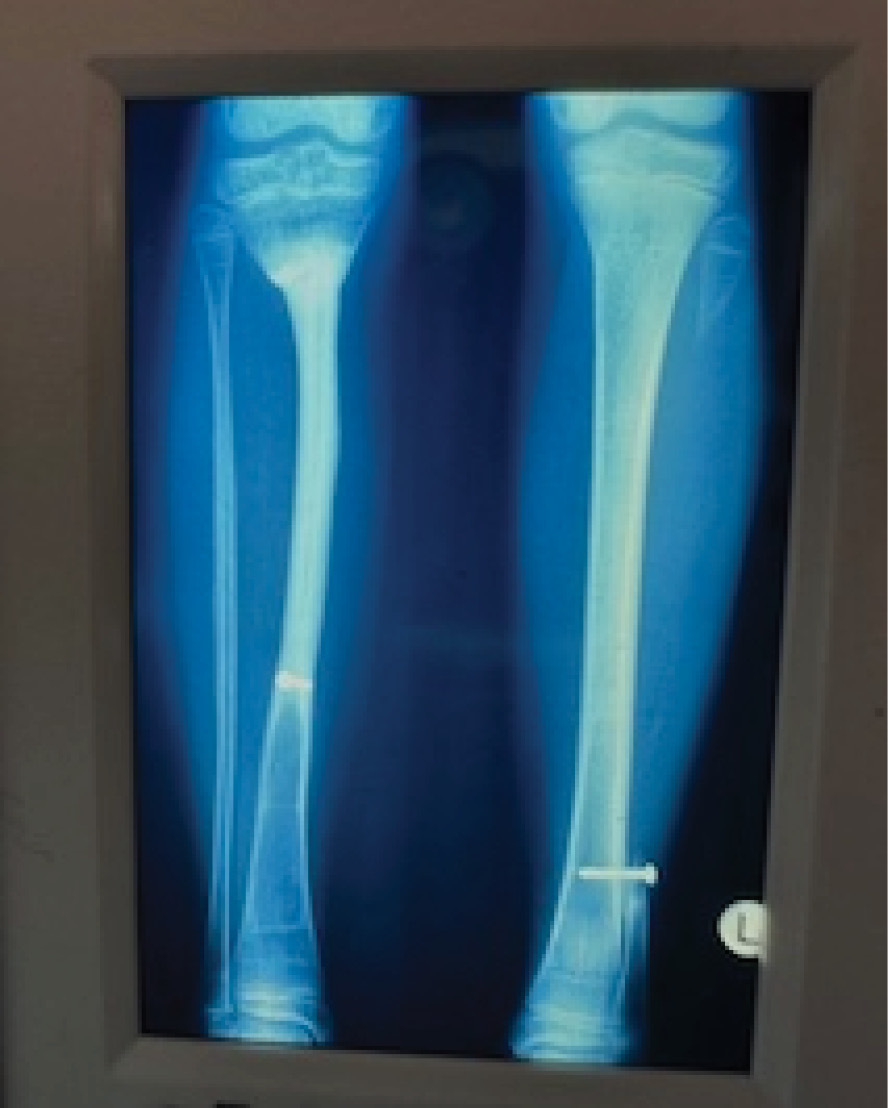 Fig 12