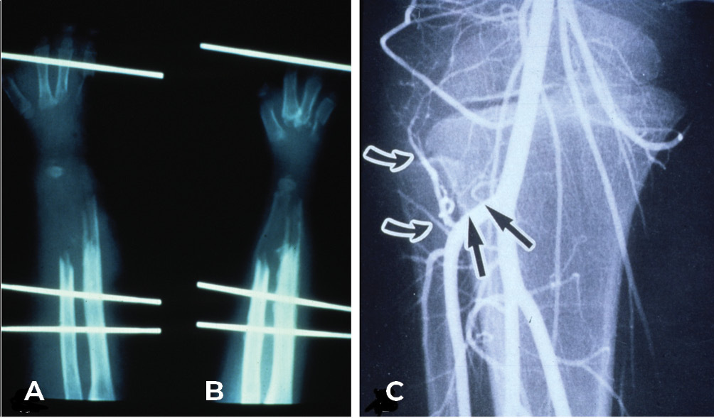 Fig 13