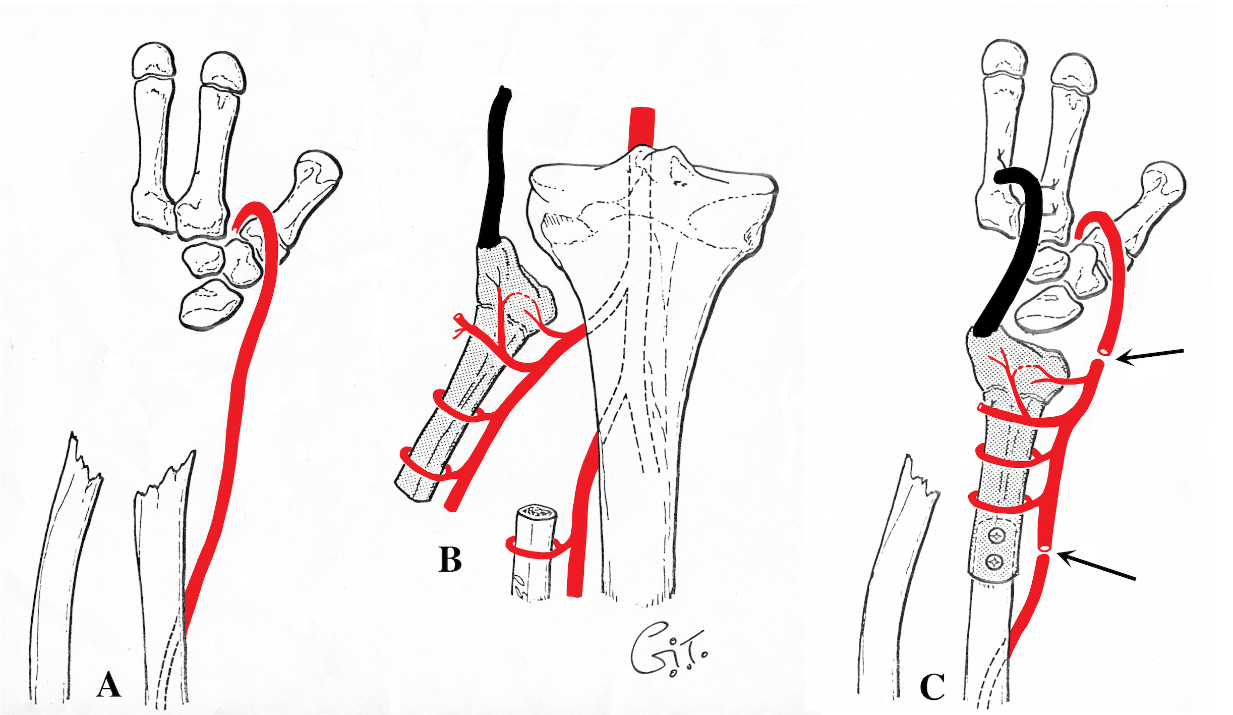 Fig 14