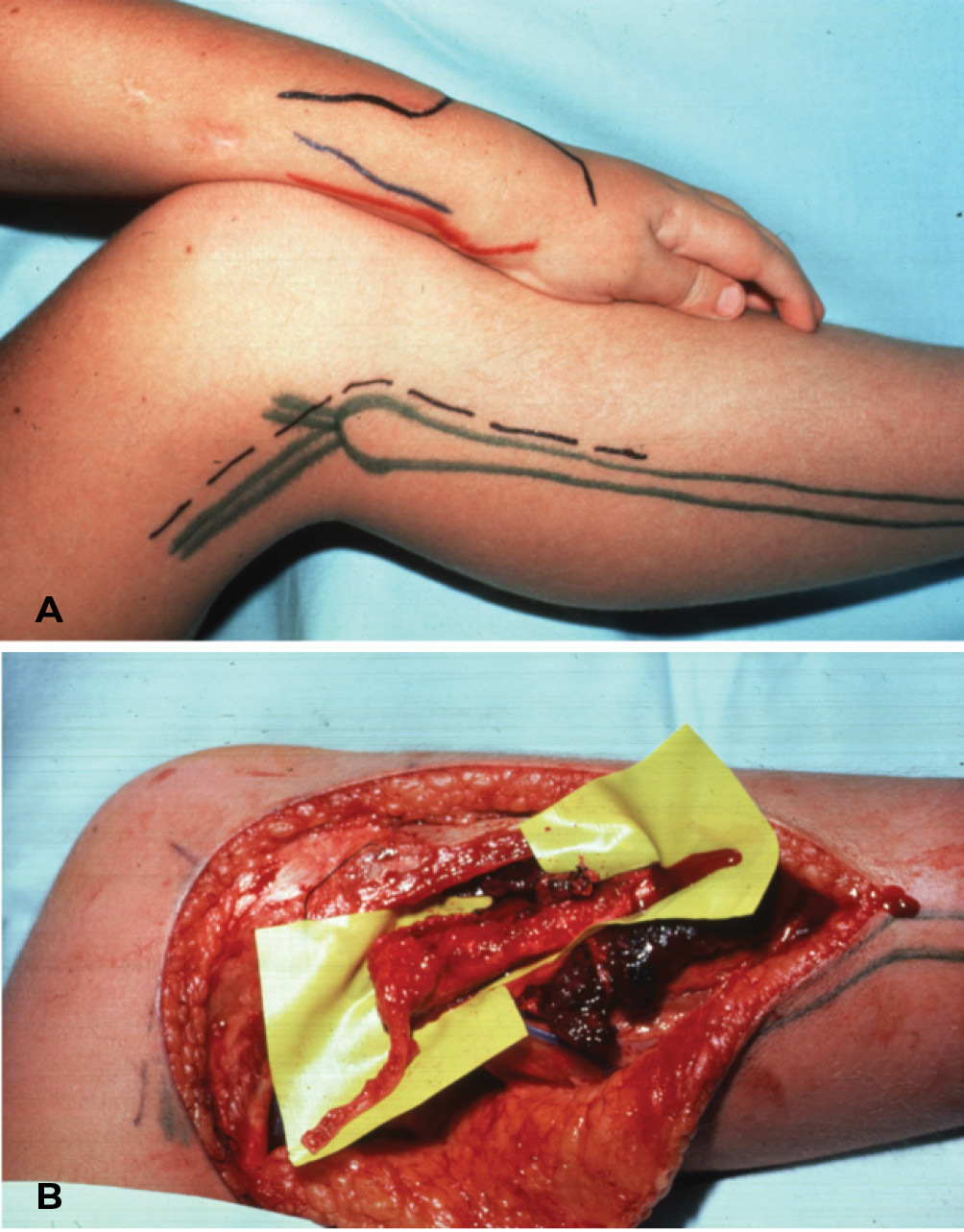 Fig 15