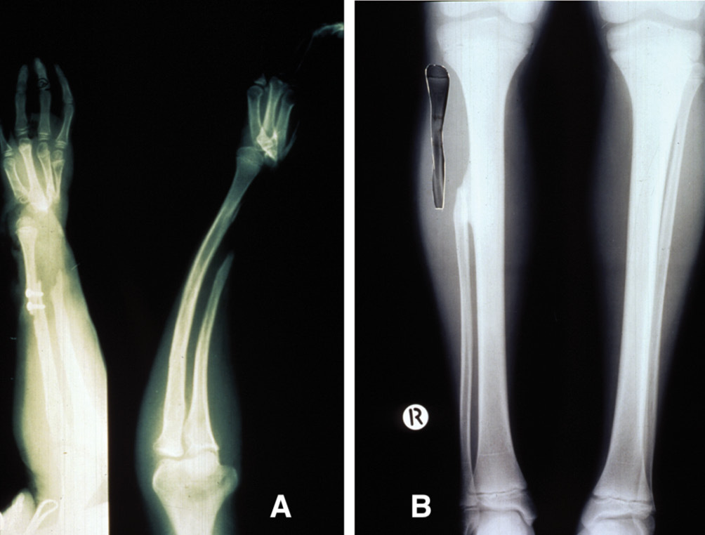Fig 16