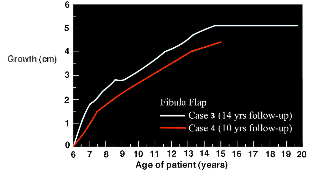 Fig 18