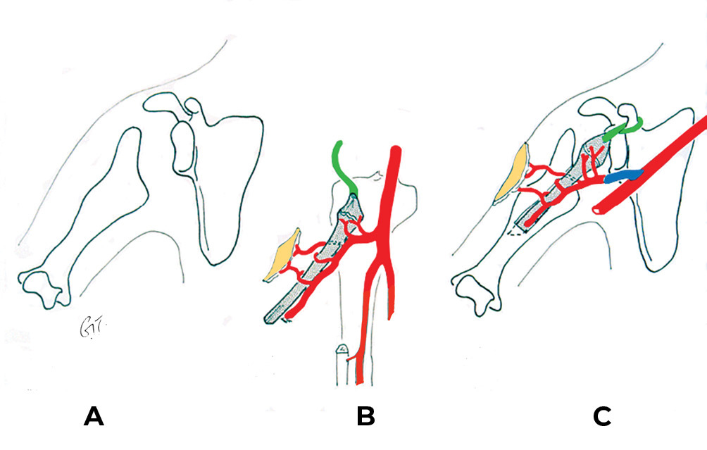 Fig 20