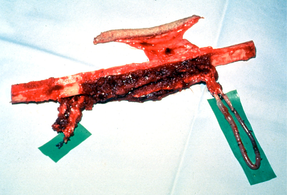 Fig 23