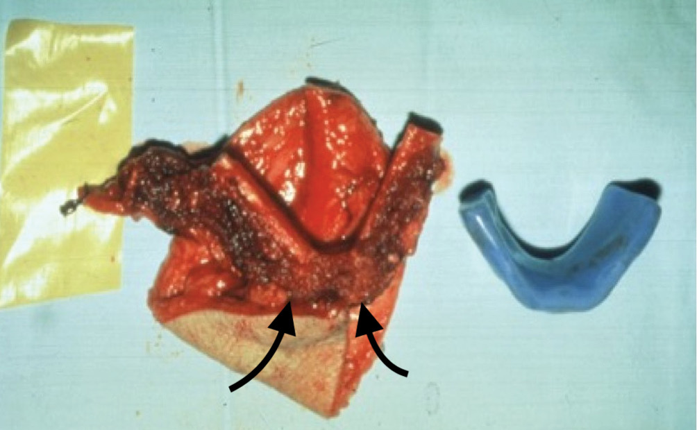 Fig 24