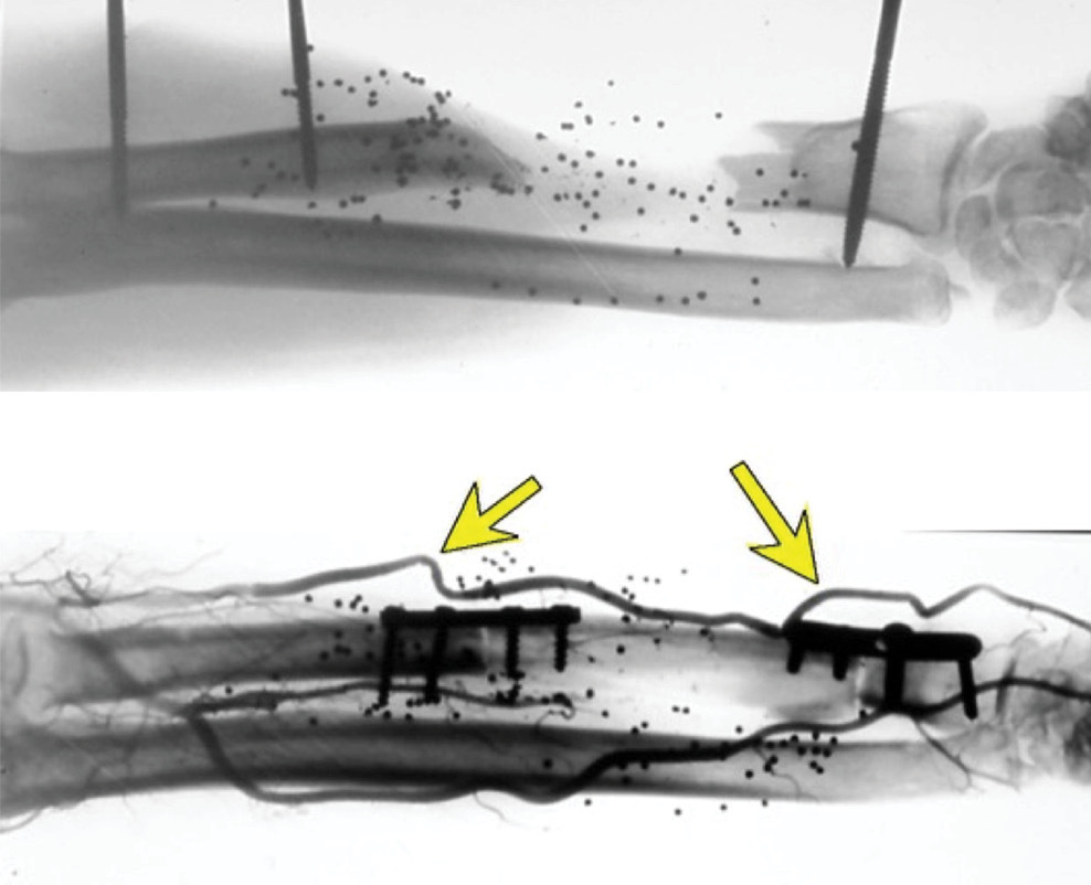 Fig 28