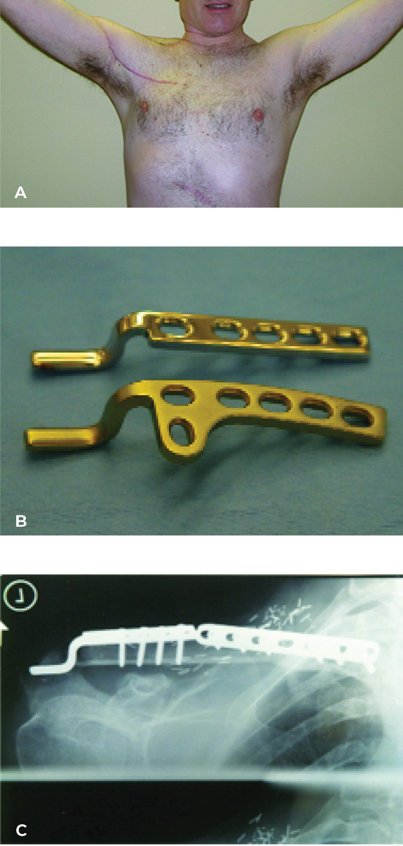 Fig 29