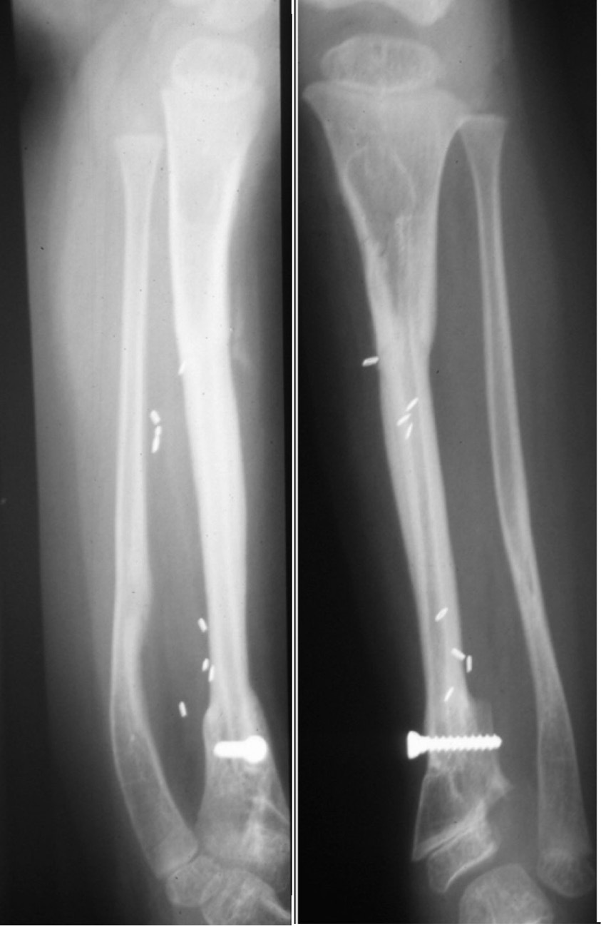 Fig 32