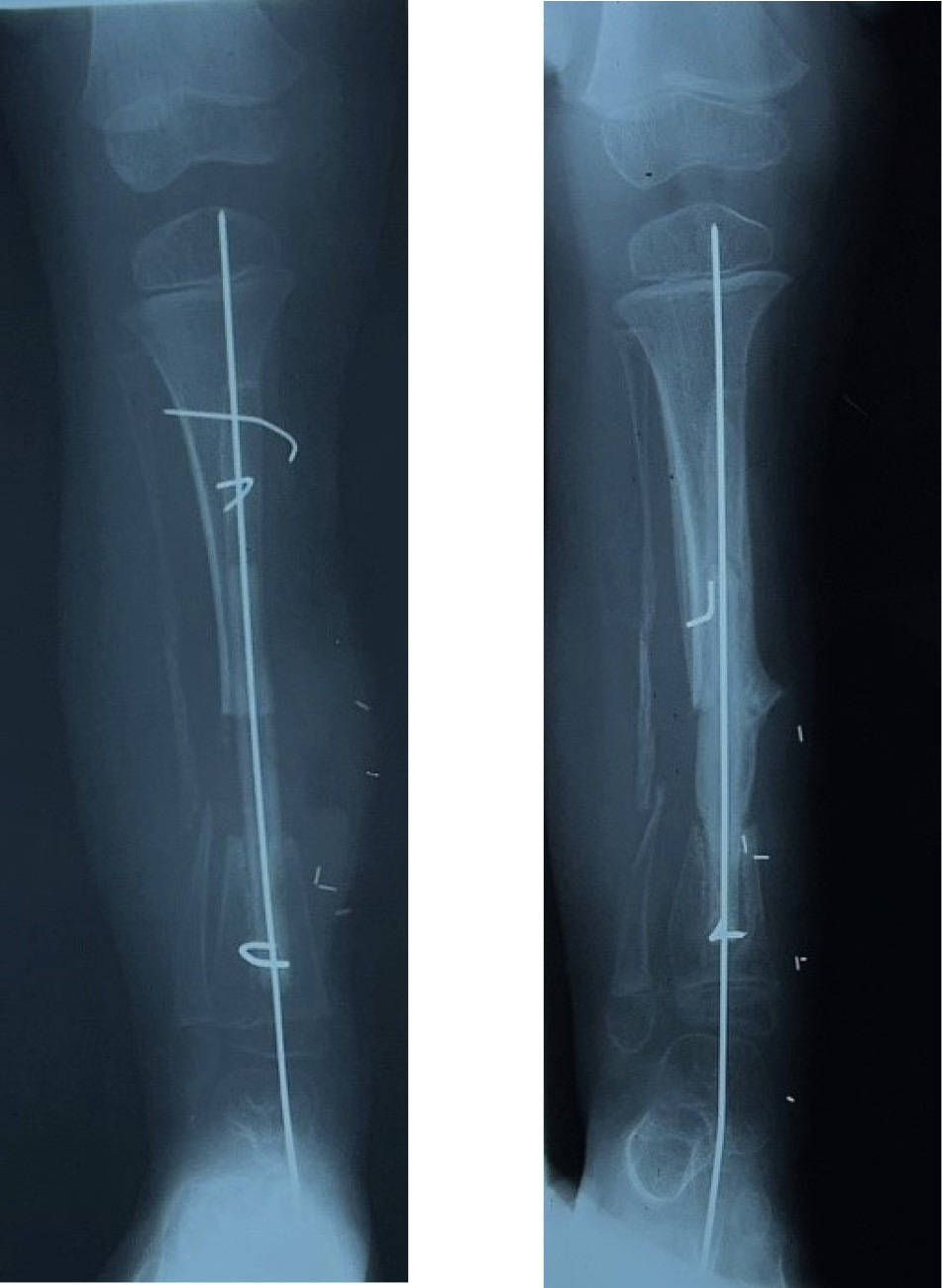 Fig 33