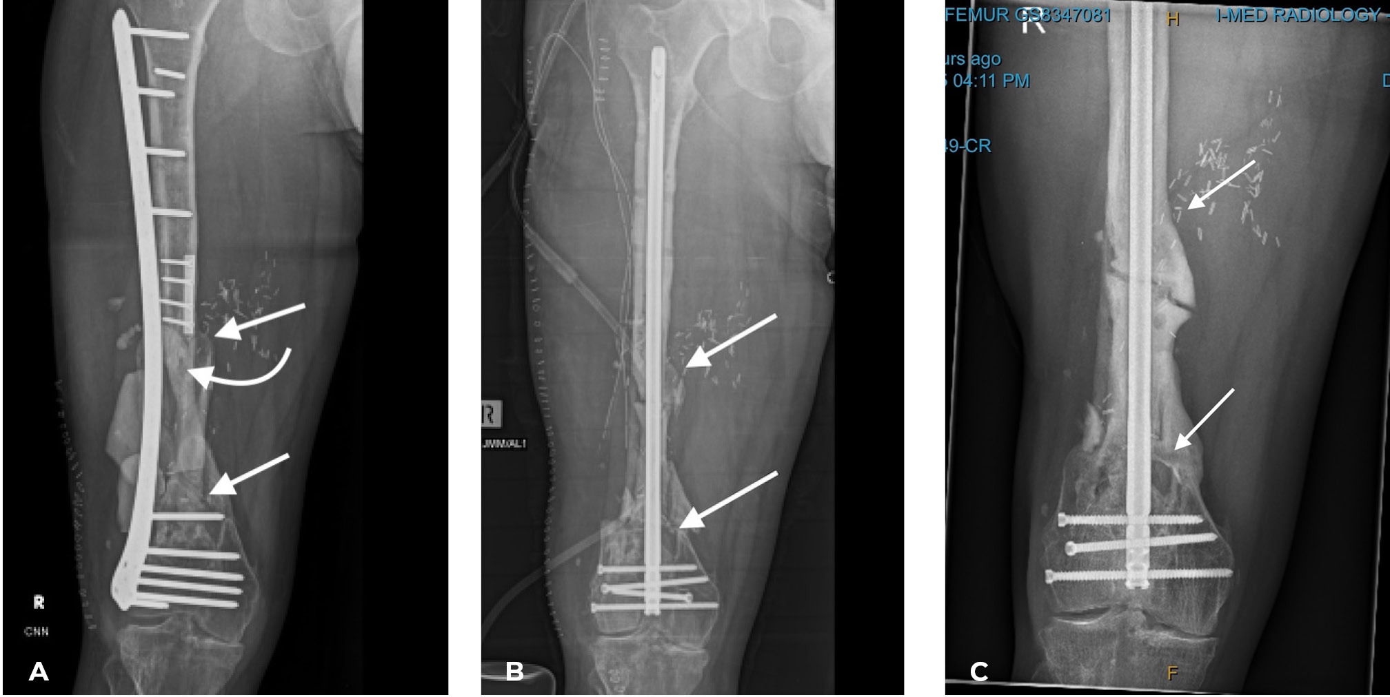 Fig 34