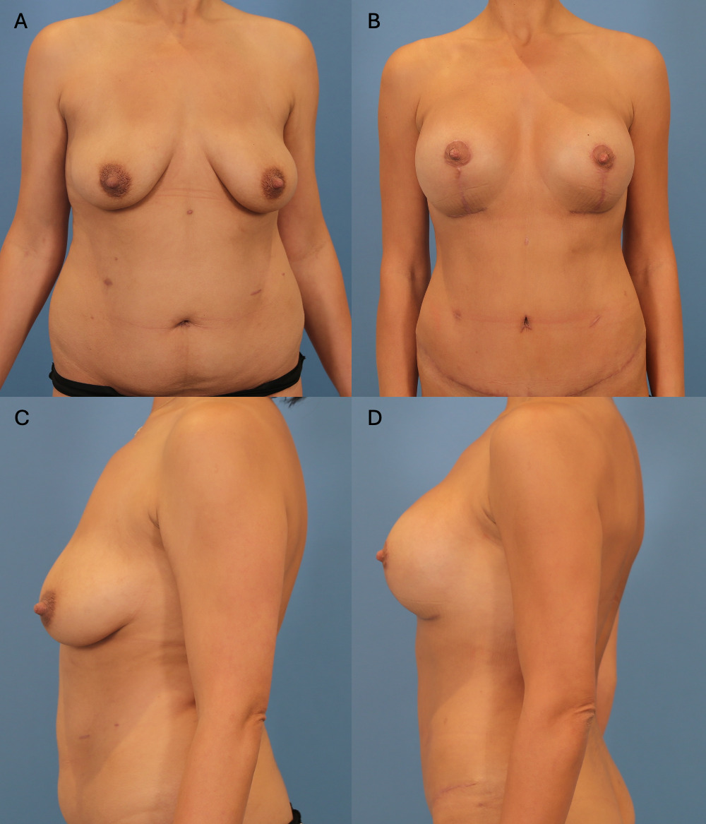 Fig 4