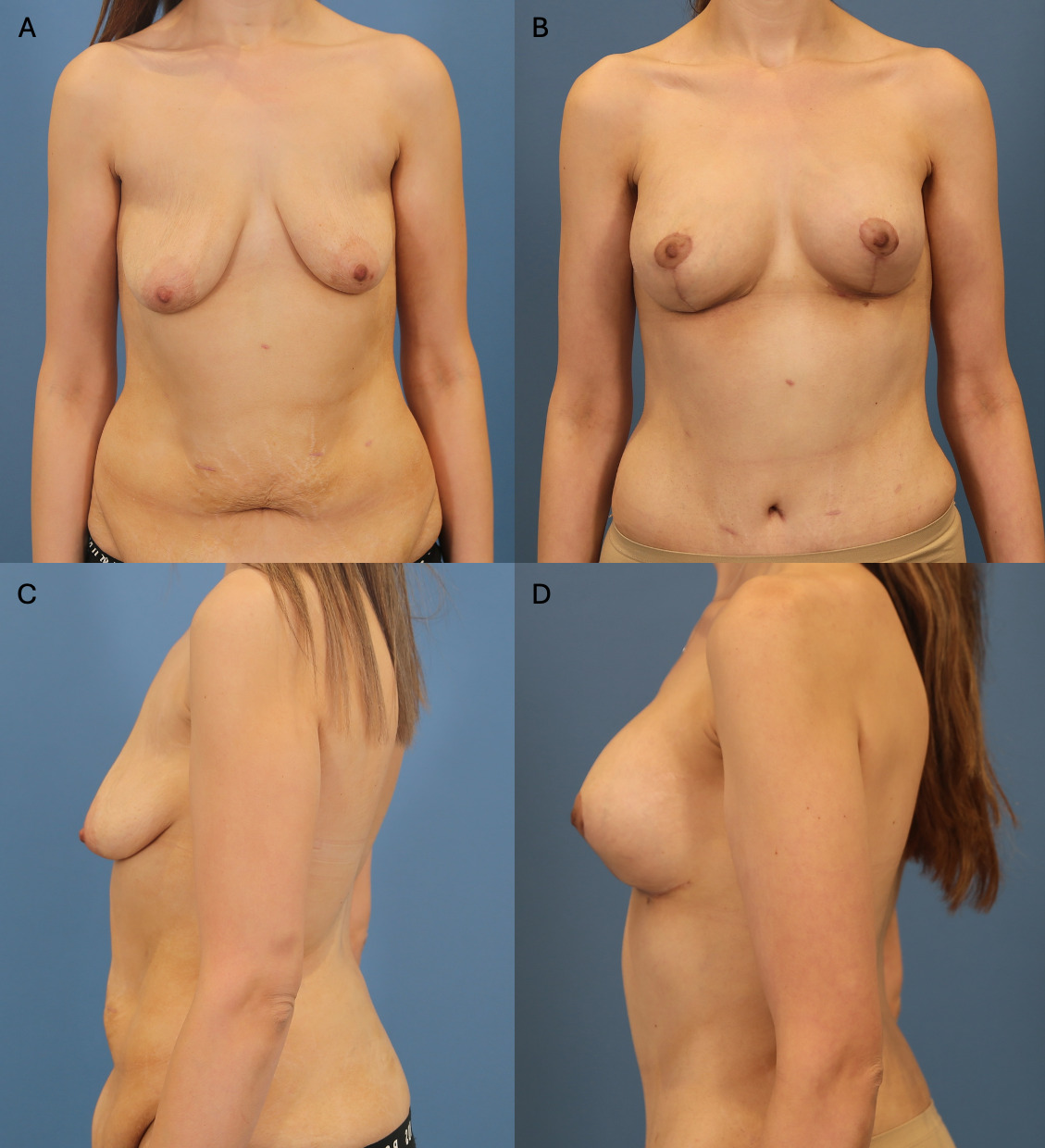 Fig 5