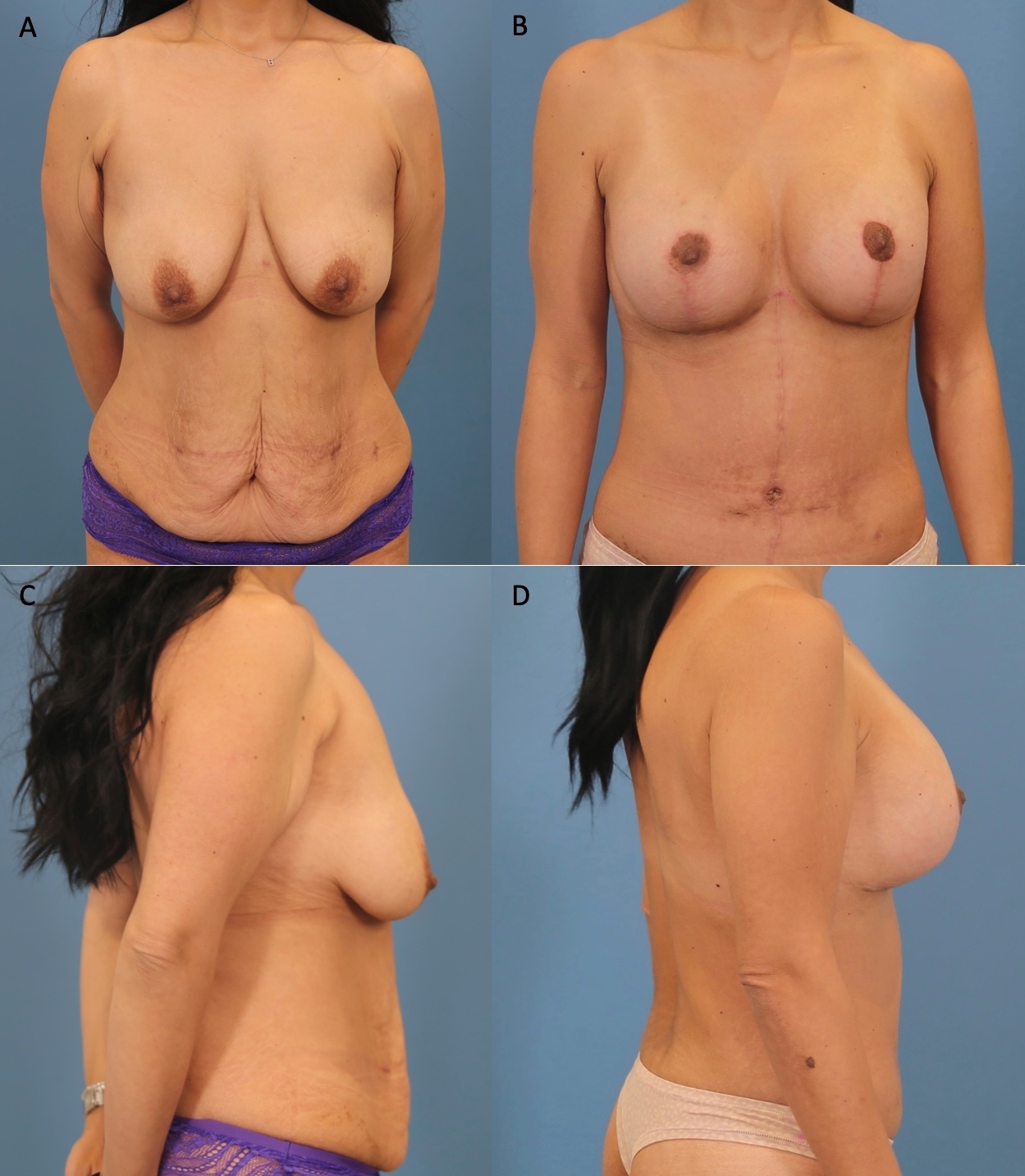 Fig 6