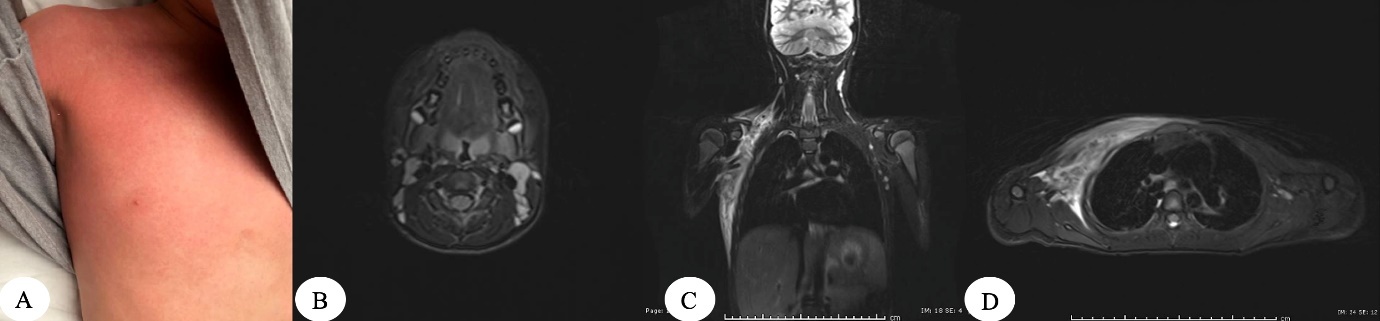 A close-up of an x-ray AI-generated content may be incorrect.