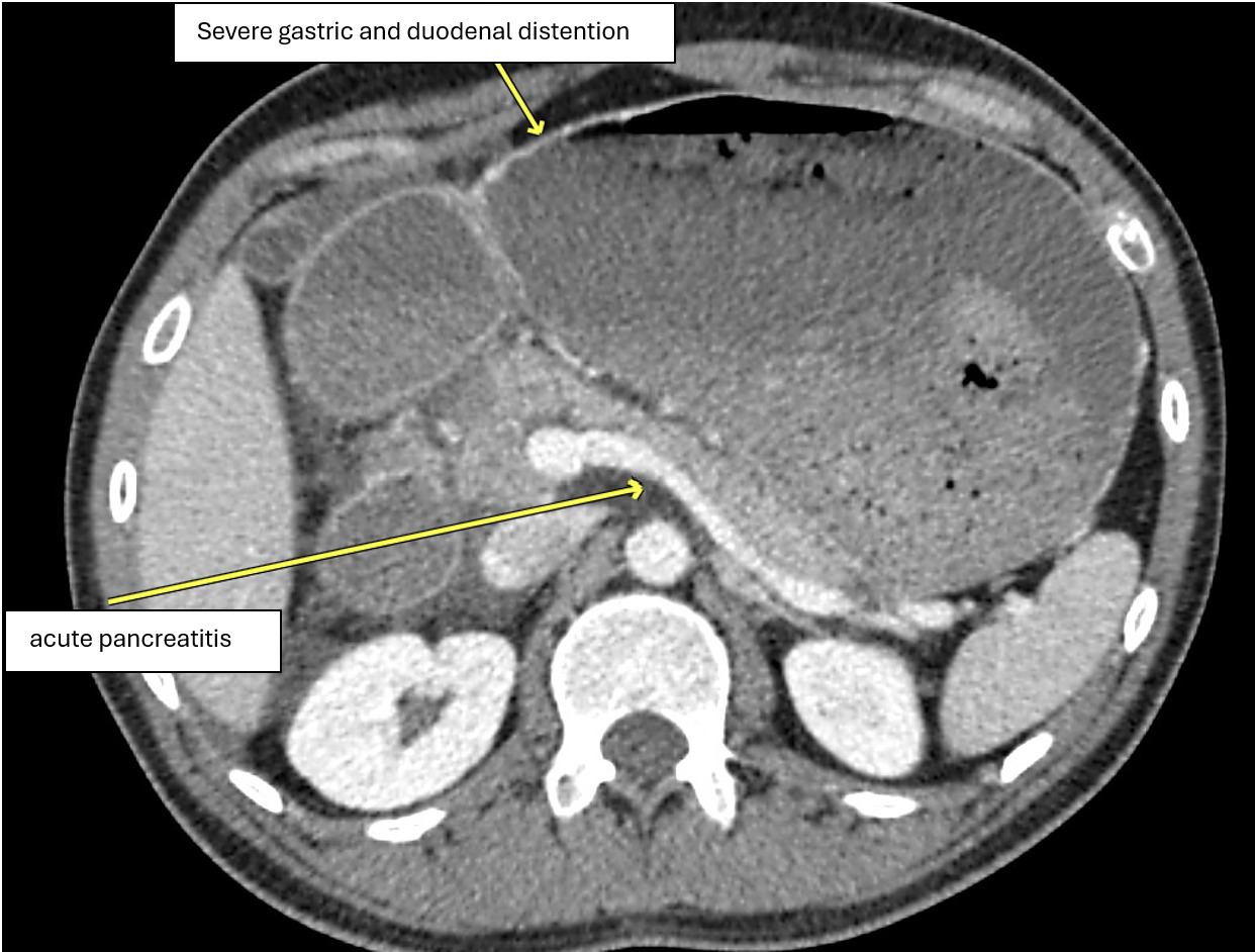 A ct scan of a body AI-generated content may be incorrect.