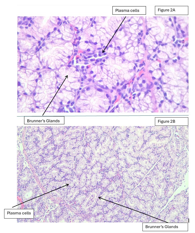 A close-up of a microscope AI-generated content may be incorrect.