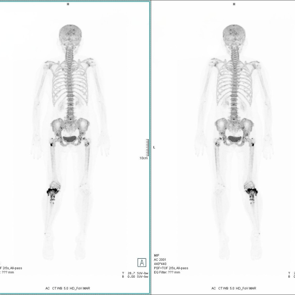 A comparison of a human body AI-generated content may be incorrect.