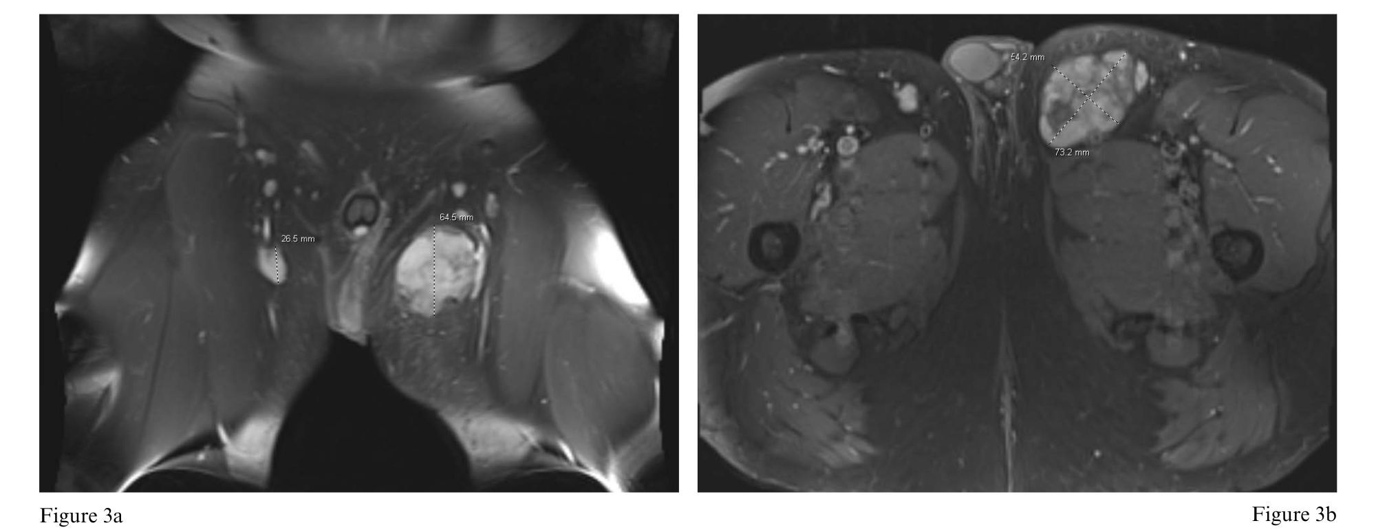 Figure 3a and 3b