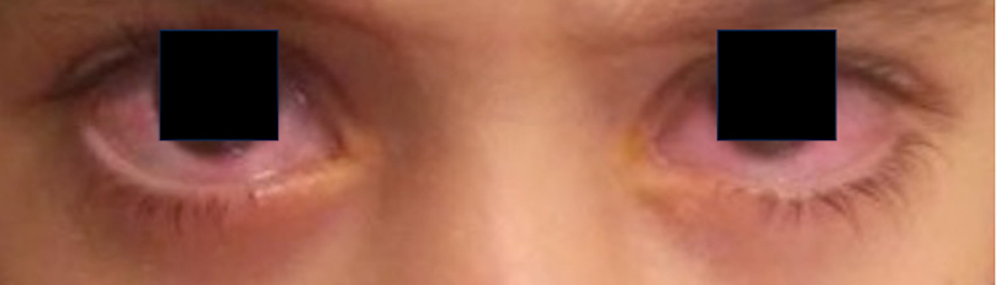 A close up of a person's face AI-generated content may be incorrect.